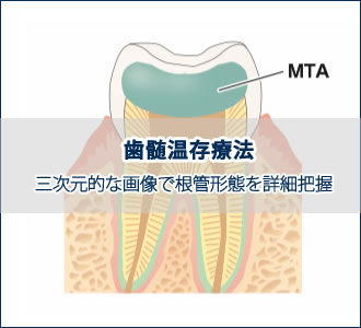 歯髄温存療法 MTA